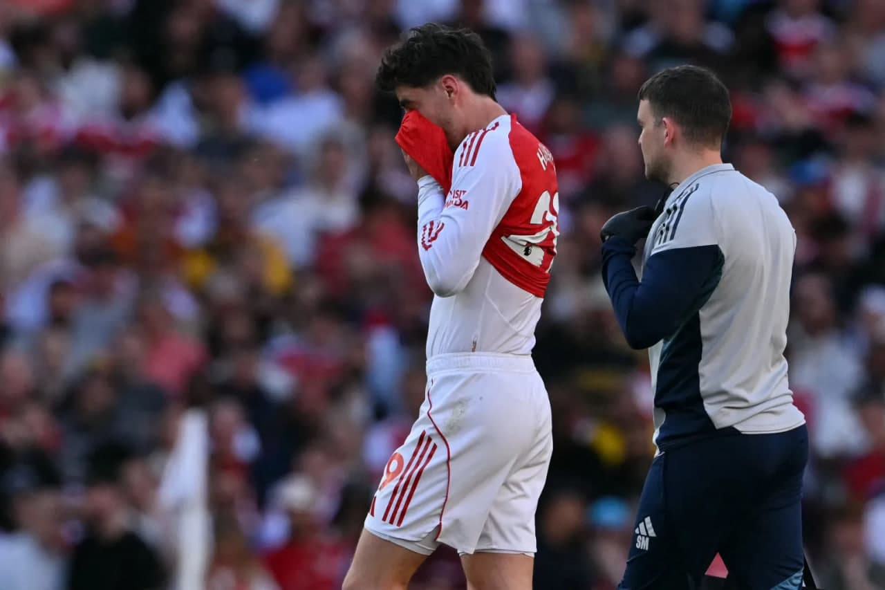 Arsenal sweating over Havertz injury in crucial title clash